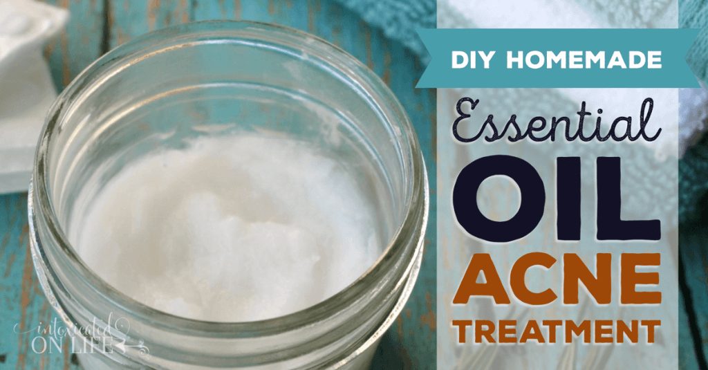 {DIY} Homemade Essential Oil Blemish Treatment